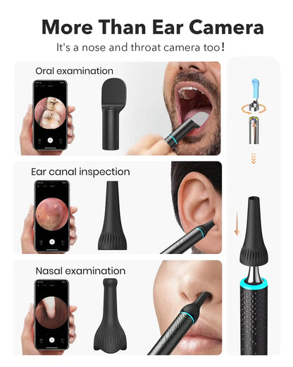 Bebird M9 Ear Wax Removal Stick